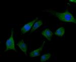 TRPA1 Antibody in Immunocytochemistry (ICC/IF)