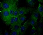 TRPA1 Antibody in Immunocytochemistry (ICC/IF)