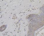 TRPA1 Antibody in Immunohistochemistry (Paraffin) (IHC (P))