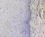 TRPA1 Antibody in Immunohistochemistry (Paraffin) (IHC (P))