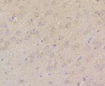 TRPA1 Antibody in Immunohistochemistry (Paraffin) (IHC (P))