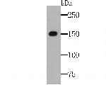 TRPA1 Antibody in Western Blot (WB)