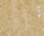 RyR3 Antibody in Immunohistochemistry (Paraffin) (IHC (P))