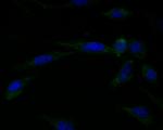 Connexin 45 Antibody in Immunocytochemistry (ICC/IF)