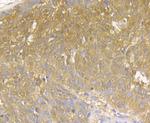 MICA/B Antibody in Immunohistochemistry (Paraffin) (IHC (P))