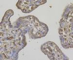 STIM2 Antibody in Immunohistochemistry (Paraffin) (IHC (P))