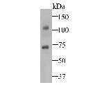 STIM2 Antibody in Western Blot (WB)