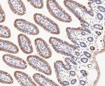 DFNA5 Antibody in Immunohistochemistry (Paraffin) (IHC (P))