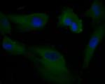 AKT3 Antibody in Immunocytochemistry (ICC/IF)