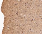 AKT3 Antibody in Immunohistochemistry (Paraffin) (IHC (P))