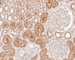 AKT3 Antibody in Immunohistochemistry (Paraffin) (IHC (P))