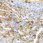 A1CF Antibody in Immunohistochemistry (Paraffin) (IHC (P))