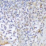 A1CF Antibody in Immunohistochemistry (Paraffin) (IHC (P))