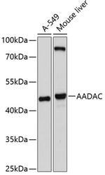 AADAC Antibody in Western Blot (WB)