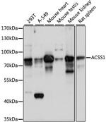 ACSS1 Antibody in Western Blot (WB)