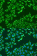 Centaurin alpha-1 Antibody in Immunocytochemistry (ICC/IF)