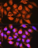 ALDH1B1 Antibody in Immunocytochemistry (ICC/IF)