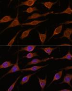 ALG5 Antibody in Immunocytochemistry (ICC/IF)