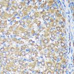 ALG5 Antibody in Immunohistochemistry (Paraffin) (IHC (P))