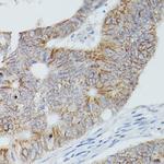 ALPL Antibody in Immunohistochemistry (Paraffin) (IHC (P))