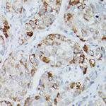 ALPL Antibody in Immunohistochemistry (Paraffin) (IHC (P))