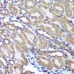 ANKLE2 Antibody in Immunohistochemistry (Paraffin) (IHC (P))