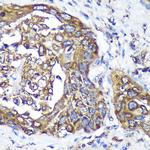 ANKLE2 Antibody in Immunohistochemistry (Paraffin) (IHC (P))