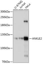 ANKLE2 Antibody in Western Blot (WB)