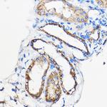 ANT1/ANT2/ANT3/ANT4 Antibody in Immunohistochemistry (Paraffin) (IHC (P))