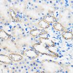 ANT1/ANT2/ANT3/ANT4 Antibody in Immunohistochemistry (Paraffin) (IHC (P))