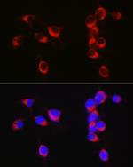 APLP1 Antibody in Immunocytochemistry (ICC/IF)