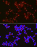 APLP1 Antibody in Immunocytochemistry (ICC/IF)