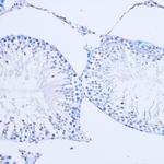 ARX Antibody in Immunohistochemistry (Paraffin) (IHC (P))