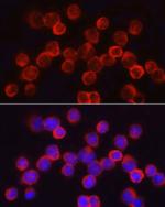 Asparagine Synthetase Antibody in Immunocytochemistry (ICC/IF)