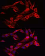 Asparagine Synthetase Antibody in Immunocytochemistry (ICC/IF)