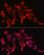 Asparagine Synthetase Antibody in Immunocytochemistry (ICC/IF)