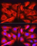 Asparagine Synthetase Antibody in Immunocytochemistry (ICC/IF)