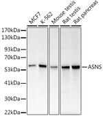 Asparagine Synthetase Antibody in Western Blot (WB)