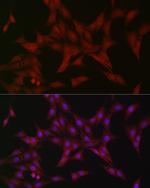 ATF5 Antibody in Immunocytochemistry (ICC/IF)