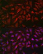 ATF5 Antibody in Immunocytochemistry (ICC/IF)