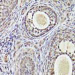 ATF5 Antibody in Immunohistochemistry (Paraffin) (IHC (P))