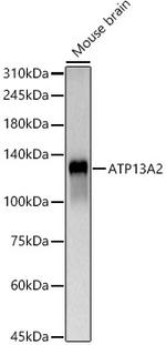 ATP13A2 Antibody in Western Blot (WB)