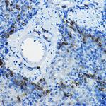 BTRC Antibody in Immunohistochemistry (Paraffin) (IHC (P))