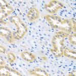 BMP3 Antibody in Immunohistochemistry (Paraffin) (IHC (P))