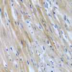 BMP3 Antibody in Immunohistochemistry (Paraffin) (IHC (P))