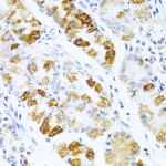 BMP3 Antibody in Immunohistochemistry (Paraffin) (IHC (P))