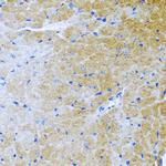 BMP3 Antibody in Immunohistochemistry (Paraffin) (IHC (P))