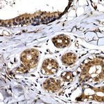 BTRC Antibody in Immunohistochemistry (Paraffin) (IHC (P))