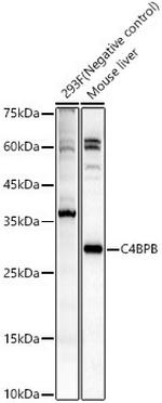 C4BPB Antibody in Western Blot (WB)