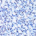 CBX8 Antibody in Immunohistochemistry (Paraffin) (IHC (P))